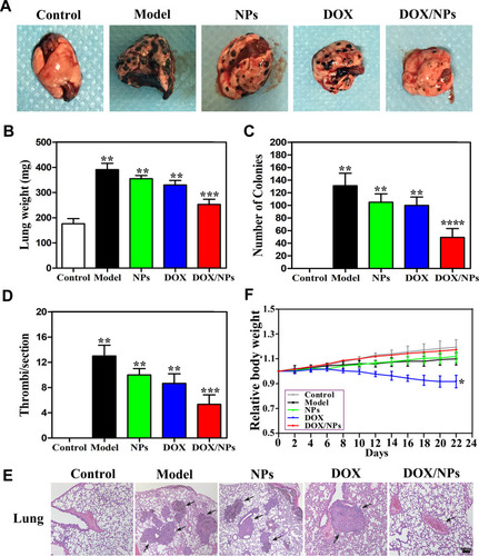 Figure 7 In vivo antimetastasis efficacy of free DOX, NPs and DOX/NPs. (A) Lung morphologies from each treatment group. (B) The weight of lungs of mice in each treatment group. (C) The number of visible colonies in the lung of each treatment group. (D) Quantification of thrombi formation within lung tissue. (E) H&E staining of lung sections harvested from each treatment group. Black arrows indicate thrombi formation induced by tumor. (F) The body weight of mice. The data represent mean ±SD. n=6–8. *p<0.05 vs control, **p<0.01 vs control, **p<0.05 vs model, ***p< 0.05 vs NPs and DOX, ****p<0.01 vs NPs and DOX.