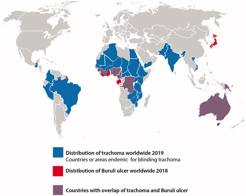 Figure 1. World map showing the distribution of trachoma and Buruli ulcer (BU). Countries colored in red have reported cases of Buruli ulcer in the year 2018. Countries colored in blue have reported trachoma cases in the year 2019 and are still considered to require intervention programs to eliminate trachoma. The purple color represents the overlap of required trachoma elimination and reported BU cases.