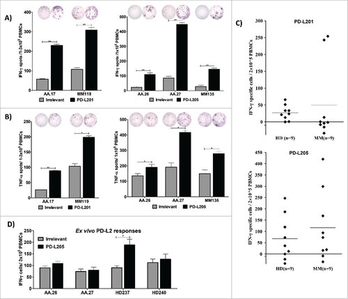 Figure 2. Natural T-cell responses towards two minimal PD-L2-derived epitopes in both patients with cancer and healthy donors. (A) Examples of IFN-γ responses against PD-L201 (PD-L24-12) and PD-L205 (PD-L216-25)(black bars) or irrelevant peptide (grey bars) in PBMCs from patients with malignant melanoma (AA and MM). All experiments were performed in triplicate, ## significant according to the DFR and DFR × 2. (B) Examples of TNF-α responses against PD-L201 (PD-L24-12) and PD-L205 (PD-L216-25) (black bars) or irrelevant peptide (grey bars) in PBMCs from patients with malignant melanoma (AA and MM), ## significant according to the DFR and DFR × 2; # significant according to only the DFR. (C) In-vitro IFN-γ ELISPOT results. PBMCs from 9 patients with malignant melanoma and 9 healthy donors were stimulated once in vitro with PD-L201 (PD-L24-12) or PD-L205 (PD-L216-25). Then, PBMCs were exposed to the peptides, and IFN-γ secretion was measured with ELISPOT. The average number of peptide-specific spots (after subtracting the number of spots without added peptide) was calculated per 2–5 × 105 PBMCs. (D) Ex vivo IFN-γ ELISPOT results. PD-L205 (PD-L216-25)(black bars) or the irrelevant peptide (grey bars) elicited responses in PBMCs from two patients with malignant melanoma (AA) and in PBMCs from two healthy donors (HD).