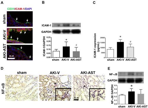 Figure 3 Immunohistochemical staining for ICAM-1 or NF-κB expression in kidney tissue from AKI mice. (A) Renal tissues were fixed in 4% paraformaldehyde and embedded in paraffin; then, sections were incubated with anti-CD31 antibodies to identify vessels (green). Immunofluorescence microscopy showed that ICAM-1 (red) was present in the renal tissues. Overlap of ICAM-1-positive cells and endothelial cell staining (CD31) is shown (orange). Scale bar = 50 μm. (B) ICAM-1 expression in the sham, AKI-V, and AKI-AST groups determined by Western blotting. n = 3 per group. (C) Plasma levels of ICAM-1 in the sham, AKI-V, and AKI-AST groups, measured by ELISA. (D and E) The expression of NF-κB in the three groups was screened using an immunohistochemistry assay. Representative photomicrographs of immunohistochemical staining for NF-κB in renal tissues from the sham, AKI-V, and AKI-AST groups. The levels of NF-κB in the cell lysates were evaluated by Western blotting. The data are presented as mean ± SEM. n = 4 per group, *p < 0.05 vs the sham group; #p < 0.05 vs the AKI-V group.