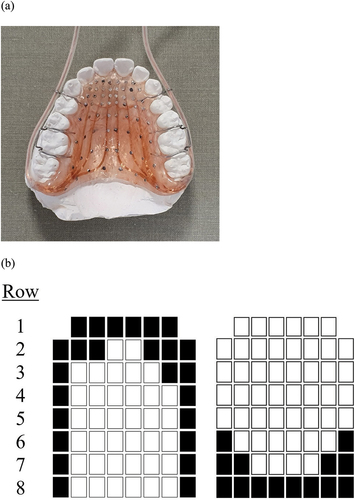 Figure 1. (a) A custom-made palatal EPG plate of the Reading system displayed on a dental plaster cast and (b) two EPG frames that show the tongue palate contact pattern typically observed in alveolar plosives /t, d, n/ (left) and velar plosives /k, ɡ, ŋ/ (right). The 62 boxes represent the 62 electrodes embedded in eight horizontal rows on the plate, with the filled boxes indicating the presence of tongue palate contact at the corresponding electrodes.
