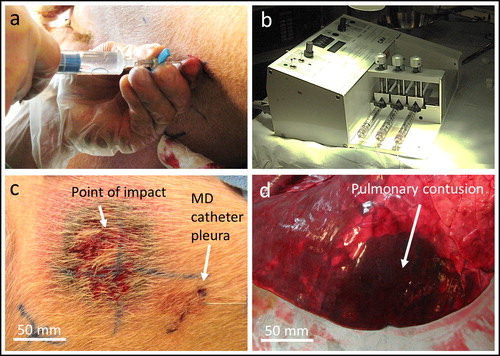 Figure 2. Photos showing (a) placement of catheter in the pleura by loss-of-resistance technique with a syringe filled with NaCl. (b) microdialysis pump. (c) skin with laceration at the point of impact, with a microdialysis (MD) catheter placed at a 50 mm distance. (d) autopsy of lungs showing the contusion with hepatized lung tissue.