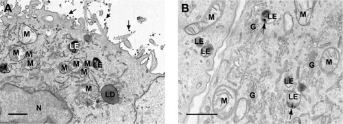 Figure 8 TEM images of human lung A549 cell line treated with laser-generated Ag-TiO2 NPs.Notes: TEM imaging was conducted on A549 cells that were treated with laser-generated Ag-TiO2 NPs (20 µg/mL) for 24 hours. Arrows in (A) indicate extracellular Ag-TiO2 NPs. Arrows in (B) indicate intracellular Ag-TiO2 NPs within late endosomes. Scale bars indicate 1 µm.Abbreviations: G, golgi; LD, lipid droplet; LE, late endosomes; M, mitochondria; N, nucleus; NP, nanoparticle; TEM, transmission electron microscopy.