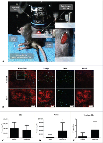 Figure 6. Comparisons of angiogenesis among transplanted kidney islets in the the control and RSV groups at day 3 after ITx. (A) Intravital imaging set up. The laser beam is projected to an animal stage, and in vivo imaging can be obtained alive in real time. (B) Representative mosaic intravital images showed merged and vessel images of islet graft in the kidneys in the control and RSV groups (Green: MIP-GFP, Red: CD31). Magnified view of the white box area is depicted in right column representing increased angiogenesis in the RSV group. Graphs of islet volume (C), vessel volume (D), and proportion of vessel volume per islet volume (E) (n = 20 fields per group, 3 independent experiments). Data are expressed as mean ± SD. *P < 0.0001.