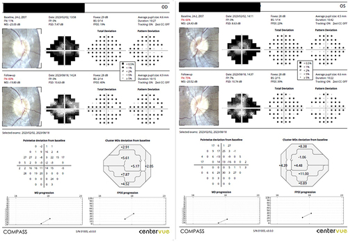 Figure 4 Patient with retinitis pigmentosa undergoing photobiomodulation therapy using the Valeda Light Delivery System and showing improvement in the visual field.