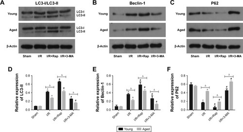 Figure 3 Expressions of autophagy-related proteins in young and aged rats, including LC3-II/LC3-I, Beclin-1 and P62 (A–C). Representative blots showing the effects of the enhancement and inhibition of autophagy upon active LC3-II/LC3-I, Beclin-1 and P62 expressions in the cytoplasm. The relative band densities of the three types of protein to the mean value of the control group in young and aged rats (D–F). Data are shown as mean ± SD (n=6). *P<0.05 vs same age sham-operated group; #P<0.05 vs the same age I/R group; ΔP<0.05 vs young group under the same interventions.