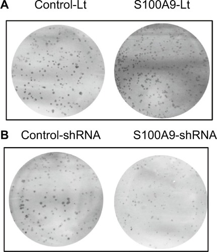 Figure 8 The effects of S100A9 expression on colony formation.Notes: (A) S100A9 overexpression, (B) S100A9 knockdown.Abbreviations: Control-Lt, control lentivirus; S100A9-Lt, S100A9 lentivirus.