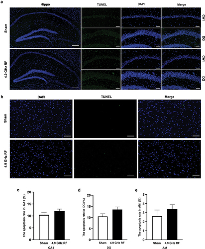 Figure 3. The effects of 4.9 GHz RF on the levels of cell apoptosis in hippocampus (Hippo) and amygdala (AM). (a) Representative images of TUNEL staining in hippocampus. Scale bar = 100 μm for Hippo, scale bar = 50 μm for CA1 and DG regions. (b) Representative images of TUNEL staining in amygdala. Scale bar = 100 μm. (c) The apoptosis rate in hippocampal CA1 region. (d) The apoptosis rate in hippocampal DG region. (e) The apoptosis rate in amygdala. All data are presented as mean ± SEM.