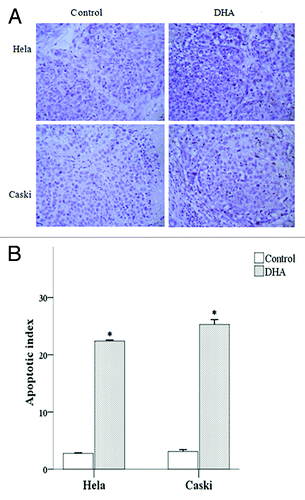 Figure 8. Effect of DHA on cell death in Hela and Caski cell lines. (A) TUNEL-staining of untreated and DHA-treated Hela and Caski cells. (B) Apoptotic index of untreated and DHA-treated Hela and Caski cells. *P < 0.05 indicates a significant difference between control and DHA groups for each cell line.