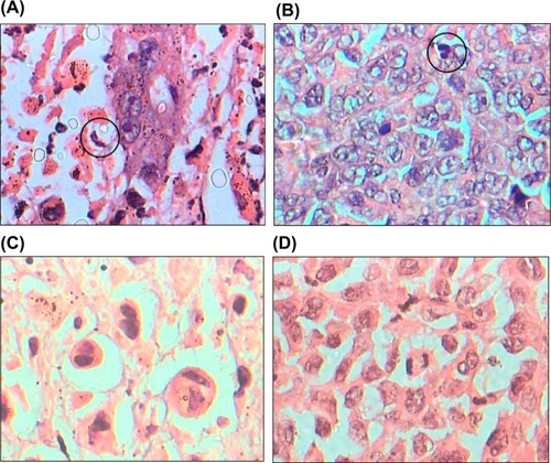 Figure 5 Representative analysis of tumor tissues with presence of typical and atypical mitoses and blood vessels.Notes: Optical microscopy at 400× magnification. The circles indicate the presence of cells under mitosis. (A) Negative control of saline, (B) control of MJ-unloaded ME, (C) positive control of DOX (single treatment with 5.0 mg/kg), (D) MJ-loaded ME (single treatment with MJ-loaded ME 5.0 mg/kg).Abbreviations: DOX, doxorubicin; ME, microemulsion; MJ, methyl dihydrojasmonate.