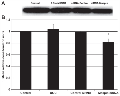 Figure 2 (A) Western blots of maspin expression from HCT-116RC cells treated with 0.5 mM DOC, siRNA control probe, or siRNA maspin probe for 24 hours. (B) Relative protein expression levels were obtained using densitometry. DOC treatment was used as an internal control to ensure that the resistant cells still maintained the same high level of maspin expression and could not be further induced by DOC. Routine staining of the entire gel with Brilliant blue indicated that all lanes received the same amount of protein.