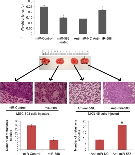 Figure 3 The photographs show dissected lungs, the arrows show the presence of nodules in lungs and the scale bar shows the size.Notes: The weight of lungs dissected was assessed and analyzed statistically. H&E staining of lung metastasis of MGC803 or SGC-7901 cells after transfection with the respective miR-588 vector. *P<0.05 compared to miR-control, *P<0.05 compared to anti-miR-NC.