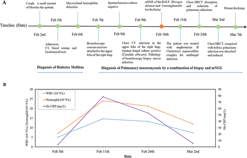 Figure 1 Timeline of diagnosis and treatment in this case. (A) The timeline recorded essential events of the patient during hospitalization. The Orange dot indicates mNGS test, and the green dots indicate other test items and key events. (B) Trends in inflammatory indicators.