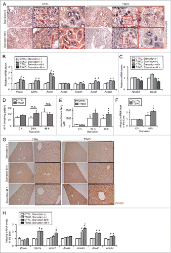 Figure 7. Impairment of lipid utilization induced by autophagy-deficiency under prolonged starvation is compensated by ketone bodies. Metabolic and energetic changes of atg5F/F-CTRL and atg5-TSKO mice, that were fed and starved for up to 48 h, were investigated using plasma and organs including kidney and liver (n = 7 to 9 in each group). (A) Representative images of immunostaining of PPARA in the kidney cortical regions. Kidney sections were immunostained for the proximal tubule marker LRP2/MEGALIN in blue. (B to E) mRNA expression levels of genes related to lipid β-oxidation (B) and to mitochondrial oxidative phosphorylation (C), ATP content per protein in the kidney (D), and plasma ketone body concentration (E) are shown. (F) mRNA expression level of Hmgcs2 in the liver. (G) Representative images of immunostaining for PPARΑ in the liver. Tissue sections were counterstained with hematoxylin. (H) mRNA expression levels of genes related to lipid β-oxidation in the liver. (B, C, F and H) Data are expressed as the fold change relative to the mean value of fed atg5F/F-CTRL mice. Cpt1a, carnitine palmitoyltransferase 1a, liver; Acads, acyl-Coenzyme A dehydrogenase, short-chain; Acadl, acyl-Coenzyme A dehydrogenase, long-chain; Acadvl, acyl-Coenzyme A dehydrogenase, very long chain. Bars: 50 μm (A) and 100 μm (G). All images are representative of multiple experiments. Data are provided as mean ± SE. Statistically significant differences (*P < 0.05 vs. 48-h starved atg5F/F-CTRL mice; #P < 0.05 vs. fed mice) are indicated. n.s., not significant. CTRL, atg5F/F-CTRL mice; TSKO, atg5-TSKO mice.