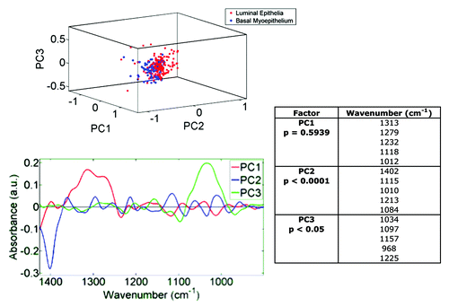 Figure 5. Unsupervised exploratory analyses by principal component analysis (PCA) of infrared (IR) spectra derived from luminal cells vs. basal, myoepithelal of cells in breast terminal ductal lobular units (TDLUs; n = 3) and extracted from image maps. A PCA scores plot shows good segregation between cells in the luminal epithelium (red symbols; n = 195) and in the basal, myoepithelium (blue symbols; n = 90) clusters. Loadings plots along principal components (PCs) were then derived in order to identify discriminating wavenumbers. Significance of category segregation along individual PCs was determined using an unpaired t-test. Distinction between 4HNE+ and 4HNE− is not needed here, as this is proof that one can separate luminal and myoepithelial cell spectra with no a priori knowledge.