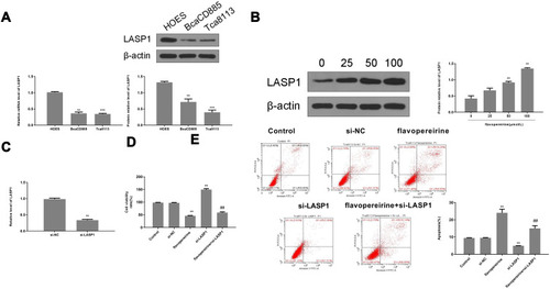 Figure 6 Flavopereirine inhibited the progression of human oral cancer cells by regulating LASP1 in vitro. (A) The expression of LASP1 in BcaCD885 and Tca8113 cells was evaluated by qRT-PCR and Western blot. (B) BcaCD885 cells were treated with different concentrations of flavopereirine for 48 h, and the expression levels of LASP1 were evaluated by Western blot. (C) BcaCD885 cells were transfected with si-LASP1 or si-NC, and the mRNA level of LASP1 was evaluated by qRT-PCR. (D and E) BcaCD885 cells were transfected with si-LASP1 or si-NC, and then treated with flavopereirine. (D) Cell viability was detected by MTT assay. (E) Cell apoptosis was evaluated by flow cytometry. **P < 0.01, ***P < 0.001 vs control group, ##P < 0.01 vs si-LASP1 group.