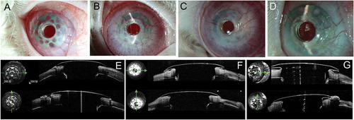 Figure 9. Implanted cornea-Kpro in rabbit 6. A. Left eye 1 month postoperatively, neovascularization was observed in the carrier corneal tissue from 2 o’clock to 3 o’clock . B. Left eye 2 months postoperatively. More vessel in the carrier cornea and air bubble beneath the flange. C. Left eye 3 months postoperatively. Neovascularization tissue could be seen beneath the flange and air bubbles disappeared. D. Left eye 8 months postoperatively. Air bubbles and debris beneath the flange. E. AS-OCT showed a small vertical gap between the anterior plate and carrier cornea 1 month postoperatively. F. AS-OCT showed tissue regeneration between the cornea and anterior plate of Kpro 3 months postoperatively. G; AS-OCT showed a gap between the cornea and posterior surface of the anterior plate 8 months postoperatively that connected to the ocular surface area on horizontal scan. On vertical scan, the corneal thinning was identified.