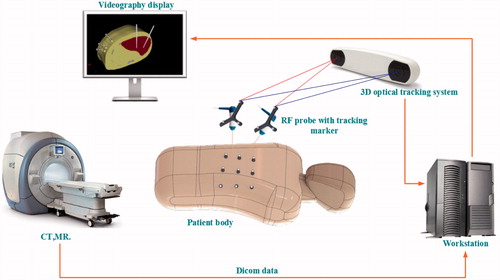 Figure 1. Near-infrared optical tracking system.