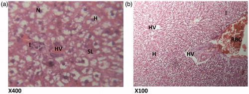 Figure 7. (Silymarin, 100 mg/kg + paracetamol). Histologic sections through the liver at magnification ×400 (a) and ×100 (b) showing area radiating hepatocytes, the sinusoidal layer and prominent portal triad and no prominent cellular degeneration and proliferation of inflammatory cells is observed. Conclusion: Not significantly affected. N – nucleus; H – hepatocytes; I – inflammation; HV – hepatic vein; SL – sinusoidal layer; RBC – red blood cell.