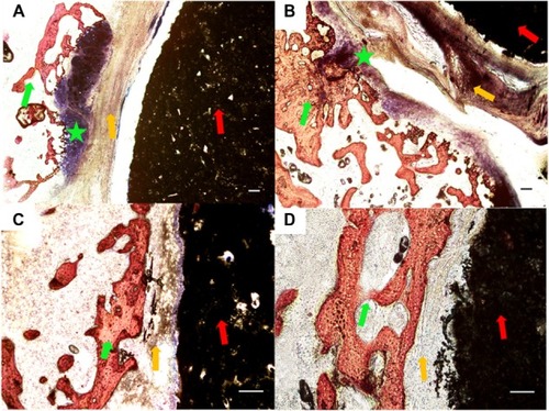 Figure 7 Histological morphologies after implantation at 4 weeks. (A) The 1:1 P/L ratio of CPC–FG; (B) 3:1 P/L ratio of CPC–FG; (C) 5:1 P/L ratio of CPC–FG; (D) pure CPC.Notes: The green star indicates cartilage; the red arrow represents materials; the yellow arrow indicates fibrous tissue; and the green arrow represents bone. Bars = 100 μm.Abbreviations: CPC, calcium phosphate cement; FG, fibrin glue; P/L, powder/liquid.