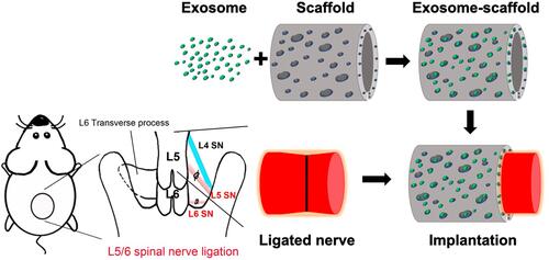 Figure 1 Schematic diagram illustrating the preparation and implantation of exosome-scaffold around ligated L5/6 spinal nerve (SN).