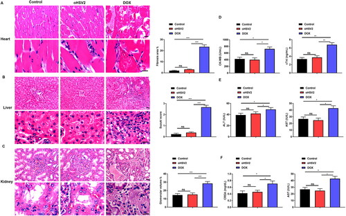 Figure 3. Safety of oHSV2 treatment in various organs of tumor bearing mice. (A) HE staining assessment of the pathological changes in the heart tissues of mice after oHSV2 or DOX treatment, Fibrosis area was calculated using a microscopic color image processing system (DpxView Pro, Korea), scale bar: 25 μm, one-way ANOVA and t-test. (B) HE staining assessment of the pathological changes in the kidney tissues of mice after oHSV2 or DOX treatment, the Suzuki score was used to quantify the pathological changes of liver tissue in terms of congestion, vacuolar degeneration, necrosis and the degree of injury, scale bar: 25 μm, one-way ANOVA and t-test. (C) HE staining assessment of the pathological changes in the liver tissues of mice after oHSV2 or DOX treatment, the volume of glomeruli in renal tissue was calculated and quantified by a microscopic color image processing system, scale bar: 25 μm, one-way ANOVA and t-test. (D) ELISA assessment of the levels of CK-MB and cTnI in the serum of mice after oHSV2 or DOX treatment, one-way ANOVA and t-test. (E) Automatic biochemical analyzer detection of the levels of ALT and AST in the serum of mice after oHSV2 or DOX treatment, one-way ANOVA and t-test. (F) Automatic biochemical analyzer detection of the level of BUN and CREA in the serum of mice after oHSV2 or DOX treatment, one-way ANOVA and t-test. ns p>.05, *p<.05, **p<.01, ***p<.001. n = 8.