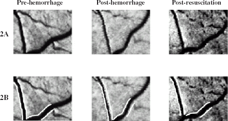 Figure 2. (A) Frame-captured images of the conjunctival microcirculation of the dog during 3 experimental phases in Oxyglobin® resuscitation. (B) Same frame-captured images as in Figure 2A with identically-spaced white lines superimposed to illustrate the changes in venular diameter.