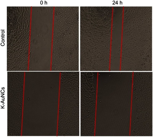 Figure 7 K-AuNCs inhibited the migration of A549 human lung cancer cells. Cells were assessed for migration with wound healing assay. Accordingly, cells were seeded and cultured until confluence was reached. A scratch was made and cells were treated with or without K-AuNCs formulation.The area of the wound was evaluated at 0h and 24h in control and treated cells.Note: *p<0.05.