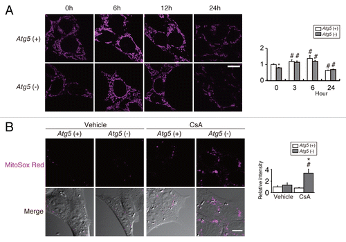 Figure 2. Autophagy protects proximal tubules from cyclosporin A (CsA)-induced mitochondrial damage. (A) Autophagy-competent [Atg5 (+)] and autophagy-deficient [atg5 (−)] kidney proximal tubular cells after treatment with either 25 μM CsA or vehicle for the indicated hours and stained with MitoTracker Red. (B) MitoSox Red staining of autophagy-competent [Atg5 (+)] and autophagy-deficient [atg5 (−)] kidney proximal tubular cells treated with either 25 μM CsA or vehicle for 24 h. Scale bars: 10 μm. The images are representative of multiple experiments (n = 3 to 8). Values are normalized to the signal intensity of untreated (A) or vehicle-treated (B) atg5 (−) cells. Data are means ± SE *P < 0.05 vs. atg5 (−) cells of the corresponding hour (A) or treatment (B); #P < 0.05 vs. untreated (A) or vehicle-treated cells (B).