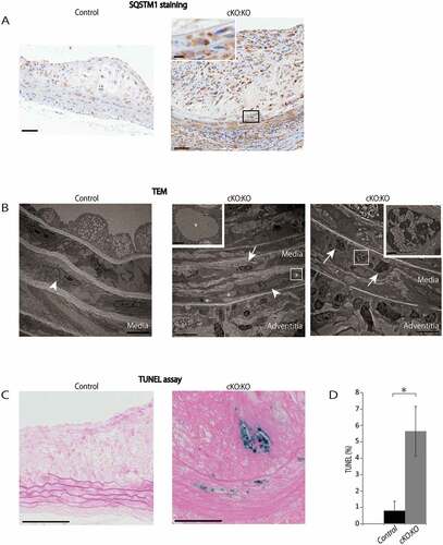 Figure 7. Atg7cKO:apoeKO mice under Western diet shows increased apoptotic cell death in plaque and media. (A) Representative histological images of abdominal aorta stained with SQSTM1 antibody from control Atg7f/f:apoeKO mice (Control) and Atg7cKO:apoeKO mice (cKO:KO) fed a Western diet. Scale bars: 50 μm. (B) Transmission electron microscopy (TEM) images of abdominal aorta from Control and cKO:KO under Western diet. The asterisks indicate cytosolic inclusions. The white arrowheads indicate SMC nuclei with normal morphology. The boxed areas indicate dying SMCs of cKO:KO with pyknotic nuclei, and their enlarged images are shown in the insets. The white arrow indicates inflammatory cell infiltration into the media. Scale bars: 1 μm in the upper panel, and 50 μm in the lower panel. (C) Representative images of the TUNEL assay and Red Counterstain C staining of the abdominal aorta of Control and cKO:KO fed a Western diet. Scale bars: 50 μm. (D) The area of TUNEL-positive lesions in the media and plaques of the abdominal aorta was evaluated. Data are mean ± SEM of 11 Control and 21 cKO:KO each. *P < 0.05 vs Control.