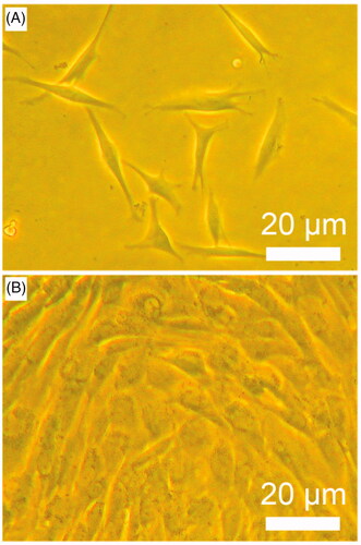 Figure 1. Primary BMSCs (A) at 3 days and passage BMSCs (B) at 7 days.