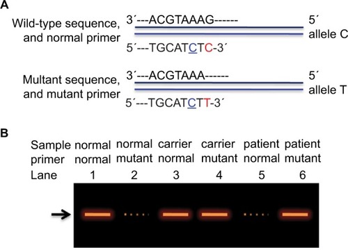 Figure 5 A diagram for ARMS strategy to diagnose CHM gene.