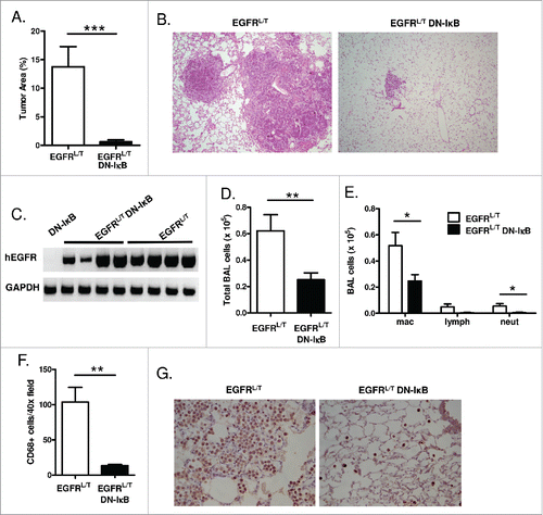 Figure 4. NF-κB inhibition reduces tumor burden and inflammatory cells in the TKI-resistant EGFRL858R+T790M lung carcinogenesis model. (A) Histological quantitation of lung tumor burden and (B) representative images from H&E-stained lung sections (10x magnification) from EGFRL/T and EGFRL/T DN-IκB mice treated with dox for 8 weeks (n = 16 mice/group; ***p < 0.001). (C) RT-PCR for EGFRL/T transgene (hEGFR) expression using mRNA isolated from lungs of EGFRL/T and EGFRL/T DN-IκB mice treated with dox for 8 weeks. (D) Total BAL inflammatory cells and (E) differential cell counts from EGFRL/T and EGFRL/T DN-IκB mice treated with dox for 8 weeks (n = 16 mice/group; **p < 0.01, *p < 0.05). (F) Quantification and (G) representative lung photomicrographs (40x magnification) of CD68 macrophage immunostaining of lung sections from EGFRL/T and EGFRL/T DN-IκB mice treated with dox for 8 weeks (n = 6–8/group; **p < 0.01).