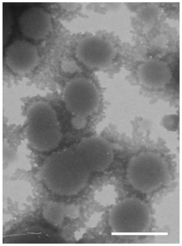 Figure 1 Transmission electron microscopy images of cationic albumin-conjugated biodegradable polymersomes negatively stained with 1% uranyl acetate solution (bar 100 nm).