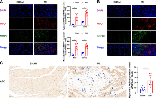 Figure 10 Expression of MPO and MMP9, SOCS3, and AQP9 in acutely MI-mice myocardium by immunohistochemistry and immunofluorescence double staining were performed using histological sections of acute MI-associated injury, as well as the relationship between expression of individual MMP9, SOCS3, AQP9 and MPO invasion. (A) Immunofluorescence double staining with antibodies against MPO (red) and SOCS3 (green); MPO is concentrated in clusters over infarction area, and SOCS3 protein deposition over myocardial cell bodies. Hoechst 33258 dye stains the nuclei blue. Bars=20 μm. (B) Immunofluorescence double staining with antibodies against MPO (red) and MMP9 (green); MPO is concentrated in clusters over infarction area, and SOCS3 protein deposition over myocardial cell bodies. Hoechst 33258 dye stains the nuclei blue. Bars=20 μm. (C) Immunohistochemistry of AQP9 MI-mice cardiac tissues stained with anti-AQP9 antibodies showed positive staining within myocardial cytoplasm compare with sham-operation mice. Bars=20 μm. Data are expressed mean ± SD, n=4 sections per group. 400 magnifications. *P < 0.05 vs sham-operated mice.