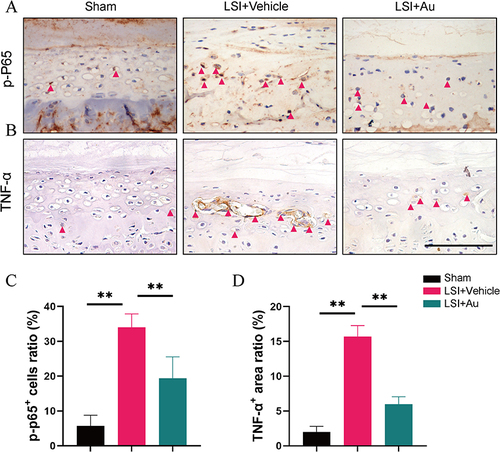 Figure 5 Au repressed LSI-induced activation of NF-κB signaling in caudal L4-5 endplate. (A and B) Representative immunohistochemical images of P-p65 and TNF-α in the caudal L4-5 endplate at 4 weeks. Red arrows indicated positive expressions. Scale bar = 100 μm. (C and D) Quantitative analyses of the percent of phosphorylated-p65 positive cells and TNF-α positive area in the endplates. The dose of Au was 10 mg/kg/day. Data were presented as means ± S.D. **p < 0.01; n ≥ 4 in each group.