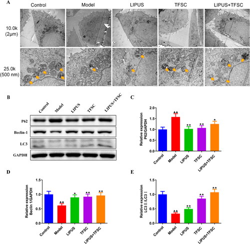 Figure 6. LIPUS combined with TFSC promotes autophagy in ovarian granulosa cells. (A) Transmission electron microscopy was used to observe changes in the ultrastructure of ovarian granulosa cells (magnification, 15,000 ×). (B–E) Western blot was used to detect the protein expression levels of p62, Beclin 1, LC3 II/I, n = 3, compared with control group, ▲p < .05, ▲▲p < .01; compared with model group, ★p < .05, ★★p < .01.