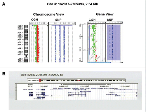Figure 1. (A) CGH/SNP array showed a 2.54 Mb terminal deletion 3p26.3 encompassing the genes CHL1 and CNTN6. The proximal breakpoint was located in the CNTN4 gene 2,705,393 bp from p telomere. (B) Image from UCSC Genome Browser showing the sizes of the terminal 3p deletion extended to band p26.3 and covered 2.54 Mb.