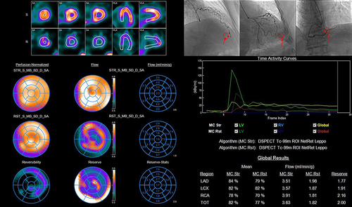 Figure 3 TIMI frame count and D-SPECT image. Arrow: Distal landmark. The area under the ROC curve of CFR in all 3 vessels was larger than that of stress MBF in the diagnosis of slow flow.