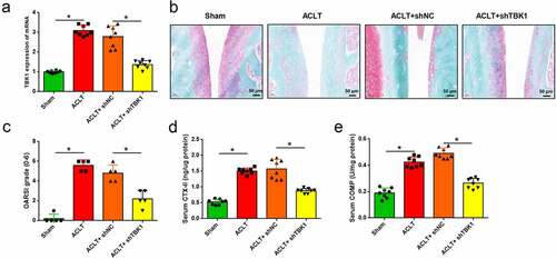 Figure 2. Silencing of TBK1 inhibited ECM degradation in OA mice. ACLT mice were infected with lentivirus shTBK1 or shNC. (a) TBK1 mRNA level was detected by qRT-PCR. (b) Safranin O-fast green staining and (c) OARSI score were used for elevating cartilage destruction. (d) Serum CTX-II and (e) COMP were analyzed by the corresponding ELISA kits. *p < 0.05.