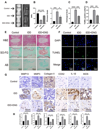 Figure 6 Engeletin ameliorated IDD in a rat model in vivo. (A) The representative X-ray and MRI images of a rat tail after 4 weeks of surgery. (B and C) The disc height index, Pfirrmann grades and histological scales were shown in different groups at 4 weeks. (E) The representative images of HE, SO-FG and AB staining of punctured IVD in different groups (scale bar: 500µm). (F and D) The representative images and semi-quantitative analysis of TUNEL staining for IVD tissues in different groups (scale bar: 25µm). (G) The expression of MMP13, MMP3, Collagen II, COX2, IL-1β and iNOS in IVD tissues at different groups were evaluated by immunohistochemistry staining (scale bar: 50µm). (H) The IOD value/area was calculated to assess the results of immunohistochemistry staining through semi-quantitative analysis. All data are presented as mean ± SD. *P <0.05, **P < 0.01, ***P<0.001 and ****P<0.0001, n = 3.
