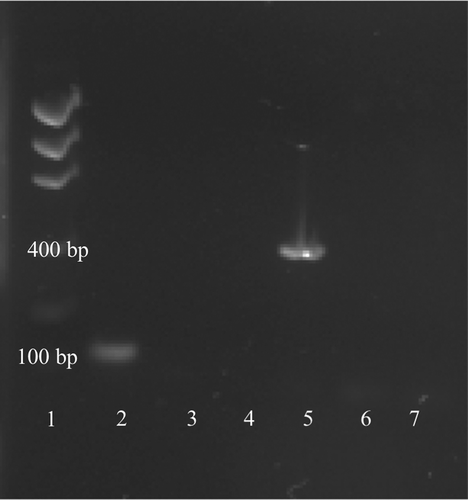 Fig. 1 PCR amplicons of conventional PCR of Alternaria and Botrytis cinerea mycelial DNA used to determine primer specificity. Lanes: 1: DNA ladder, 2: B. cinerea with Bc3/Bc3R primers (specific), 3: B. cinerea NTC, 4: Alternaria with Bc3/Bc3R primers (non-specific), 5: Alternaria with Dir/Inv1ITSAlt primers (specific), 6: Alternaria NTC, 7: B. cinerea with Dir/Inv1ITSAlt primers (non-specific). NTC = no template control