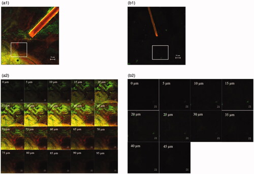 Figure 2. CLSM images (x–y plane) show follicular localization of porcine skin treated with (a1) a rhodamine B base-loaded, NBD-PE-labeled microemulsion and (b1) sonophoresis combined with the rhodamine B base-loaded, NBD-PE-labeled microemulsion, observed with a 10× objective lens. The scale bar represents 50 µm. (a2) and (b2) are serial x–z planes of marked areas from (a1) and (b1), respectively, at various skin depths as observed with a 20× objective lens. The scale bar represents 20 µm.
