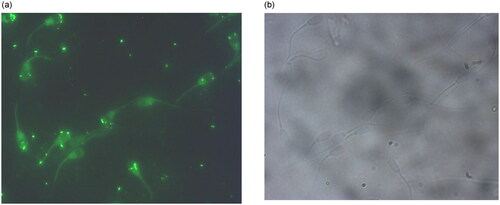 Figure 3. (a) Fluorescence and (b) phase contrast picture of aptamer bound sperm cells in mixed semen population of bovine.