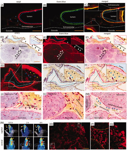 Figure 3. Trigeminal vasculatures and perivascular spaces were involved in the delivery of EB with i.d. (A–C) EB and Lyve1 distributed into trigeminal substructures; (D) Lyve1 expressed in the epineurium and perivascular tissues or tissues. (E) EB distributed along blood vessel and its surrounding tissues. (F) Trigeminal EB overlaid Lyve1 partly. (G) Lyve1 immuno-reactivity located near the blood vessel and connected to perivascular spaces, Lyve1 overlaid EB partly around the vessel. (J)-(M) Lyve1 overlaid epineurial and perineurial EB partly. (N) In-vivo living image of EB diffusion to lymphatic vessels and node. (O–Q) EB diffused into submandibular lymph nodes and lymphatic vessels. White or black arrows: perineurium, epineurium or lymphatic vessel; blue arrows or dash circles: lymphatic vessels; yellow arrows: perivascular spaces; blue arrows and dash line: blood vessel. The bar is 50 μm, (A–C) 10×; (D–F) and (N) 10×; (A–C), (G-I) and (O–Q) 20×.