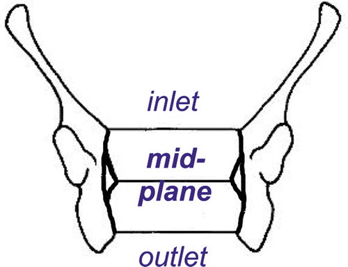 Figure 28. Pelvic planes (from Tague Citation1986, with permission).