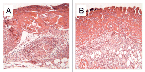 Figure 2 Sections of 4 mm diameter defects at 3 days. (A) Fibrin control, note poorly organized dermis. (B) HUCPVC in fibrin, note the obvious presence of cells within the fibrin and the resulting maintenance of dermal thickness. Field width for each image: 858 µm.