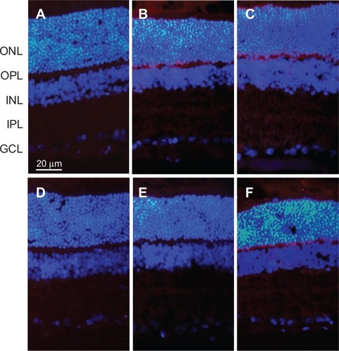 Figure 1 TUNEL staining for apoptotic cells in retinas at 2 weeks after intravitreal injection.Notes: (A) Low group: intravitreal injection of 2.5 mg/0.1 mL PLGA/PLA microspheres; (B) medium group: intravitreal injection of 5 mg/0.1 mL PLGA/PLA microspheres; (C) high group: intravitreal injection of 10 mg/0.1 mL PLGA/PLA microspheres; (D) EPO group: intravitreal injection of 5 mg/0.1 mL EPO–dextran PLGA/PLA microspheres; (E) PBS group: intravitreal injection of 0.1 mL 0.01 M PBS; (F) normal group: normal retinas received no intravitreal injection. No apoptotic-positive cells were found in any of the retinas.Abbreviations: EPO, erythropoietin; GCL, ganglion cell layer; INL, inner nuclear layer; IPL, inner plexiform layer; ONL, outer nuclear layer; OPL, outer plexiform layer; PBS, phosphate-buffered saline; PLGA/PLA, poly(lactic-co-glycolic acid)/poly(lactic-acid); TUNEL, terminal deoxynucleotidyl transferase-mediated dUTP nick end labeling.