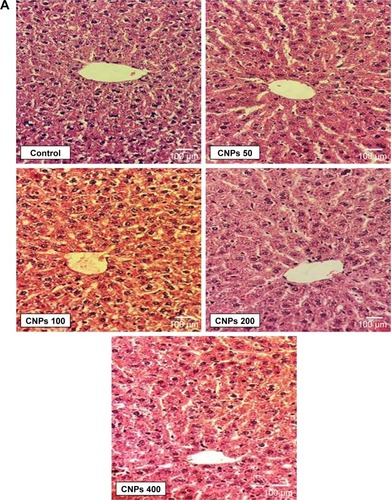 Figure 1 (A, B) Histopathological findings in liver and kidney of male Wistar rats after treatment with CNPs for 14 days (H&E, 400×).Abbreviation: CNPs, cerium oxide nanoparticles.