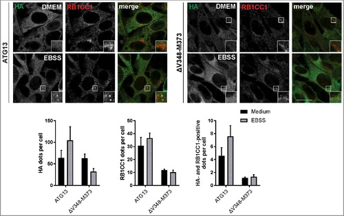 Figure 3. Disruption of the RB1CC1-binding region in ATG13 inhibits mutual recruitment to the phagophore. atg13 KO MEFs retrovirally transfected with cDNA encoding either HA-ATG13 or HA-ATG13(ΔV348-M373) were seeded onto glass cover slips one day prior to stimulation with full medium (DMEM) or starvation medium (EBSS) for 1 h. Cells were fixed, permeabilized and stained for HA (covance MMS-101P) and RB1CC1. An inverse confocal laser scanning microscope was used for imaging. Puncta and colocalization per cell quantification was done using fiji software. Data represent mean + SEM. A minimum of 168 cells per stimulation was analyzed. Statistical analysis using the Student t test, 2-sample assuming unequal variances was performed comparing EBSS to DMEM for each individual cell line. No statistical significance with P < 0.05 was obtained. Columns for control (ATG13) are reused in figures 4, 6, and supplementary figure S9. Scale bar: 20 µm.